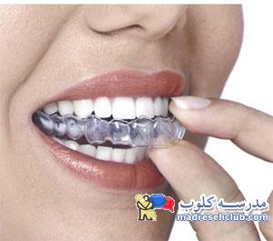 آیا برای متوقف کردن دندان قروچه، میتوان کاری انجام داد؟